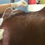 Mesotherapy performed on a back for pain