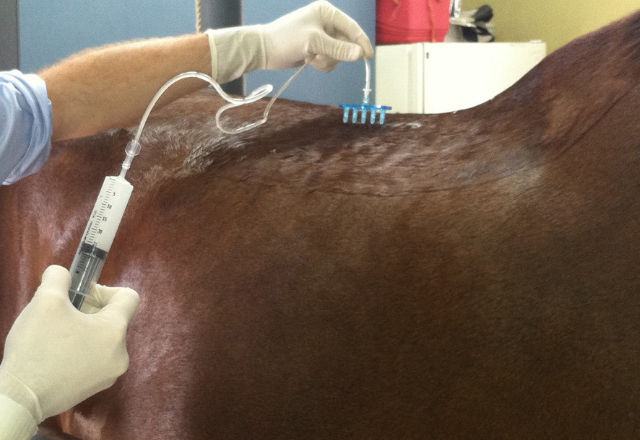 Mesotherapy performed on a back for pain