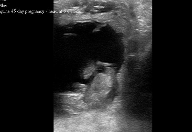Ultrasound Image 45 day pregnancy
