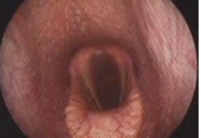 An image from an endoscopic exam.