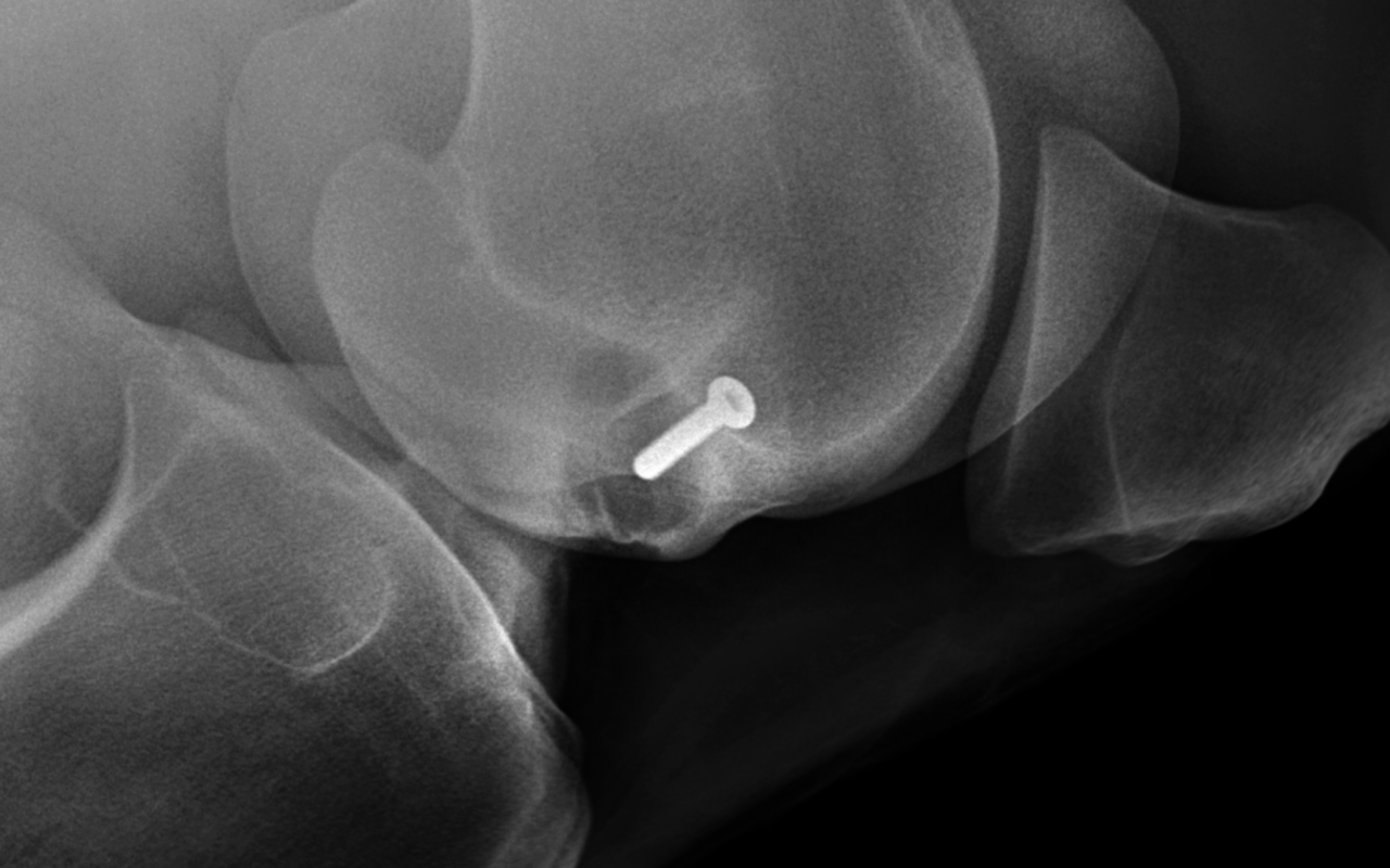 Radiography of stifle with lesion post surgery