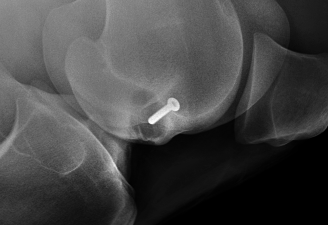 Radiography of stifle with lesion post surgery